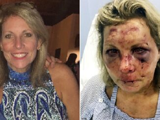 Woman who claims she was brutally beaten during her Dominican Republic vacation is suing the resort.