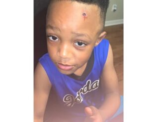 boy returns home from school with a BULLET WOUND painted on his head