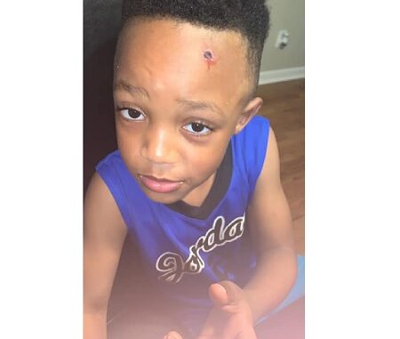 boy returns home from school with a BULLET WOUND painted on his head