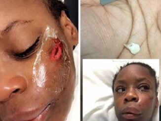 Girl, 11 hospitalized after getting hit with pole in attack motivated by racism.
