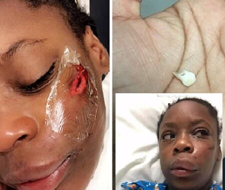 Girl, 11 hospitalized after getting hit with pole in attack motivated by racism.