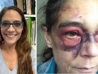 56 year-old Grandmother ends up bruised in Jail after calling 911 for help.