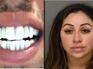 Woman Arrested For Using Nail Glue To Apply Illegal Veneers.