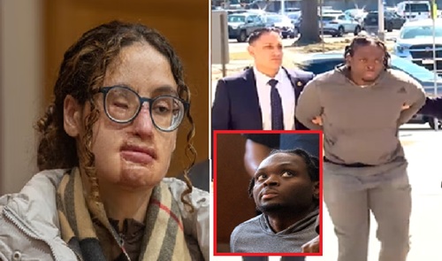 Second Suspect Charged in 2021 Acid Attack on Long Island College Student