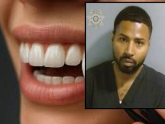 Atlanta Veneer Specialist Claims He Didn’t Know His Work Was Illegal
