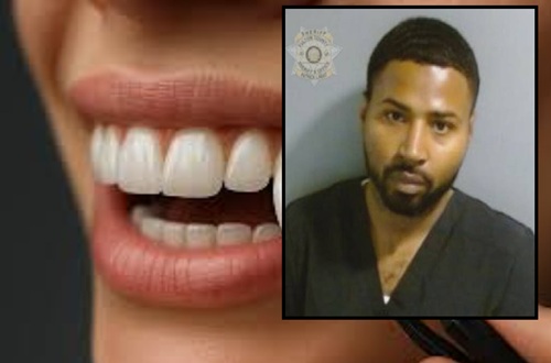 Atlanta Veneer Specialist Claims He Didn’t Know His Work Was Illegal