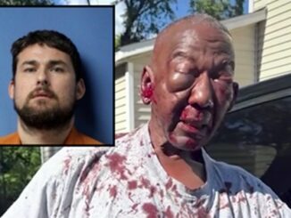 70 year old johnny white assaulted