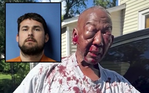 70 year old johnny white assaulted