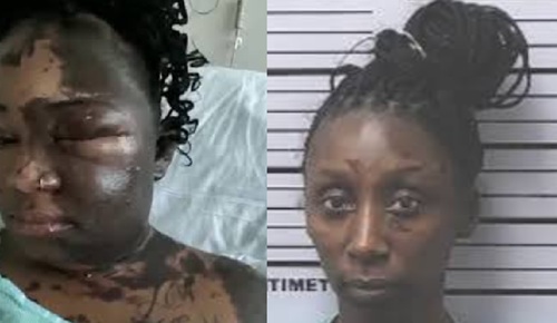 Georgia Woman Convicted After Allegedly Throwing Heated Chemical on Friend, Leaving Her Permanently Injured