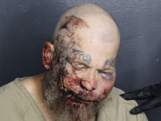 Man Tells Cop “I Want To Fight You” — Ends Up With Swollen, Bloodied Mugshot.