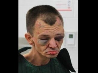 2 Former Jail Officers Charged After Allegedly Beating 66-Year-Old Inmate So Badly He Suffered Brain Bleed.
