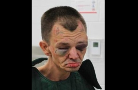 2 Former Jail Officers Charged After Allegedly Beating 66-Year-Old Inmate So Badly He Suffered Brain Bleed.